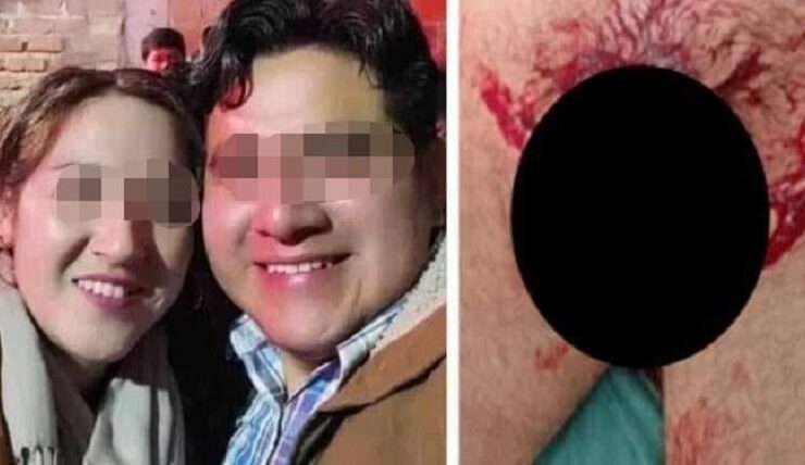 Una mujer, en medio de un aparente ataque de celos, le habría cortado el pene a su pareja mientras este se encontraba durmiendo