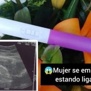 Mujer se embaraza estando ligada hace 4 años