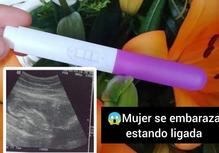 Mujer se embaraza estando ligada hace 4 años