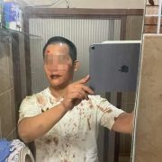 Joven asegura que fue golpeado y drogado en un bar de Mérida donde desaparecieron sus amigas