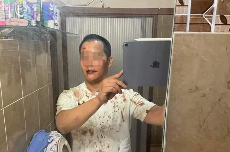 Joven asegura que fue golpeado y drogado en un bar de Mérida donde desaparecieron sus amigas