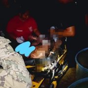 Marino sufre graves quemaduras en Mahahual, al estallarse un tanque de combustible