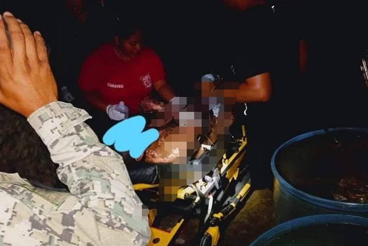 Marino sufre graves quemaduras en Mahahual, al estallarse un tanque de combustible