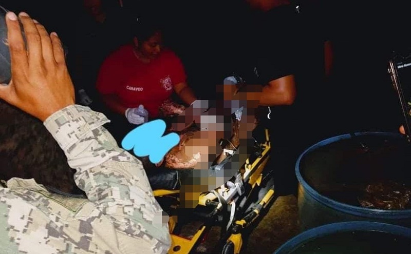Marino sufre graves quemaduras en Mahahual, al estallarse un tanque de combustible