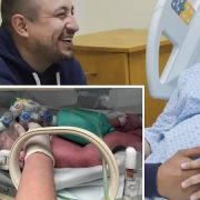 Separan a siamesas recién nacidas en Nuevo León