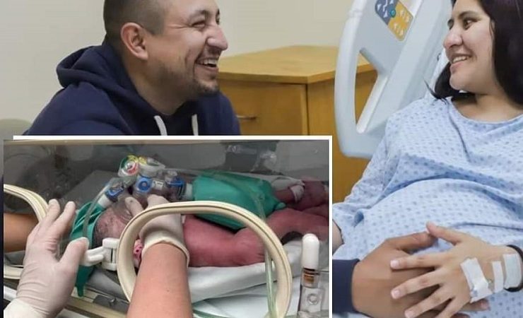 Separan a siamesas recién nacidas en Nuevo León