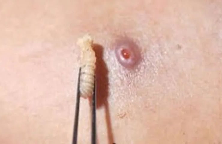 El primer fallecido por un gusano barrenador