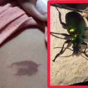 Escarabajos "bombarderos" en Yucatán: sueltan químicos que queman la piel