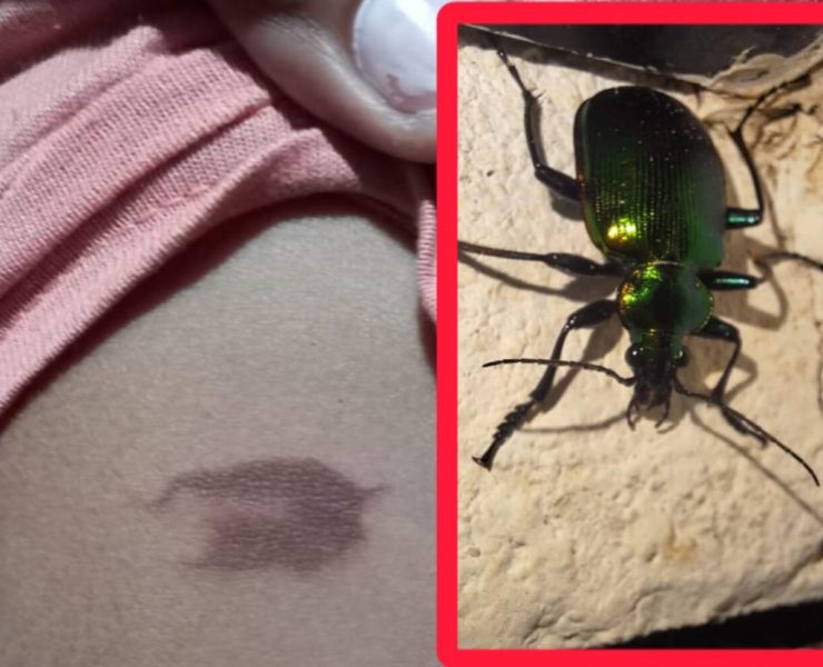 Escarabajos "bombarderos" en Yucatán: sueltan químicos que queman la piel