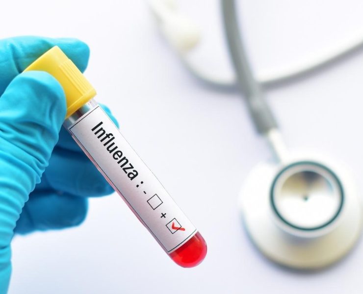 Casos de influenza en Yucatán