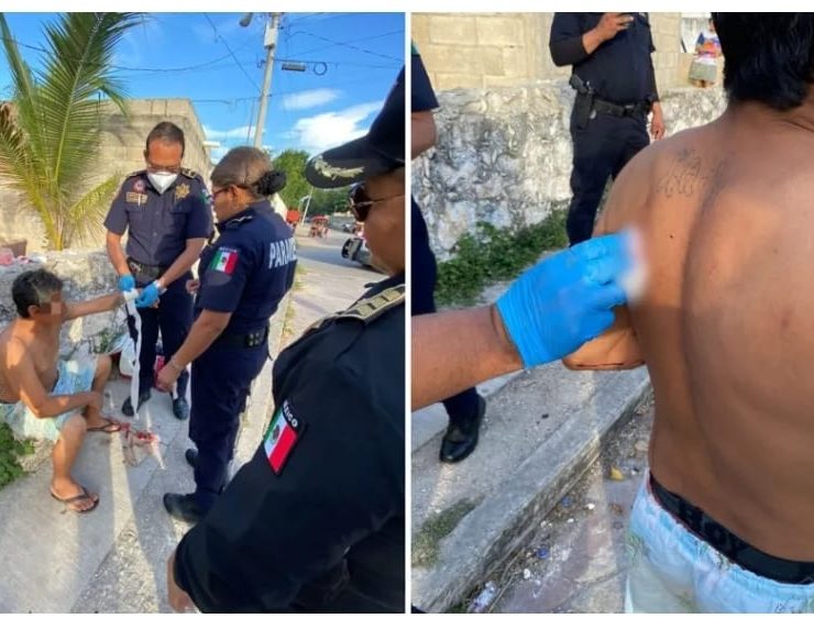 ¡Escalofriante! Pelea de pareja en Umán termina con ataque con arma blanca