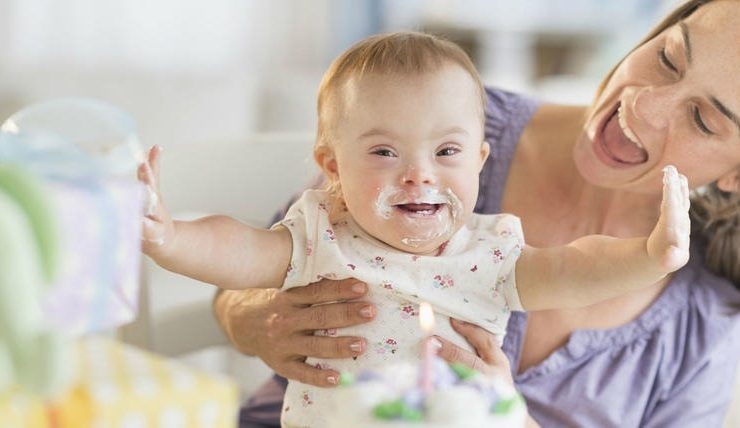 Logran eliminar el cromosoma extra del Síndrome de Down: ¿Una cura en el horizonte?