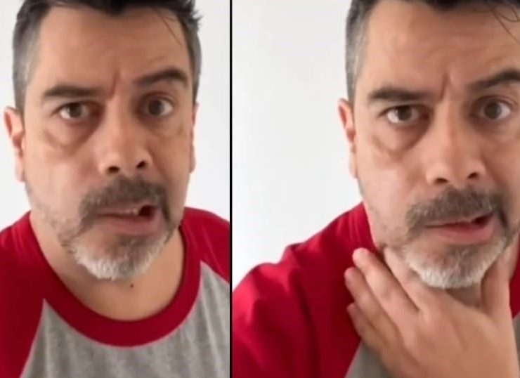 El estrés le cobra factura: Carlos Espejel sufre parálisis facial