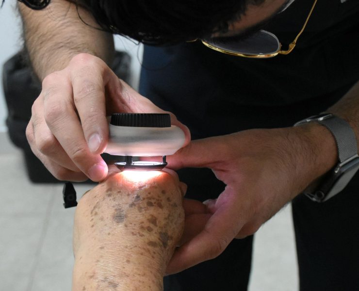 SSY pone en marcha Jornada Extramuros de Dermatología y transforma vidas en el sur de Yucatán