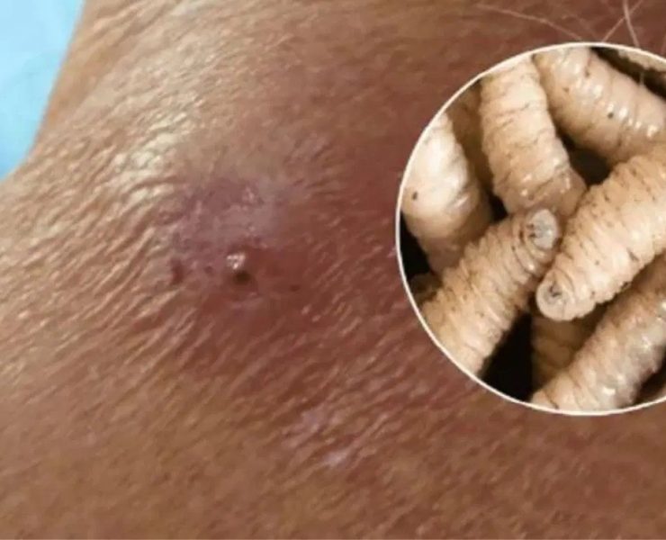 ¡Alerta en Yucatán! Detectan primera persona infectada por gusano barrenador en Yucatán