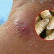 Preocupación en Yucatán: confirman otro caso de miasis por gusano barrenador