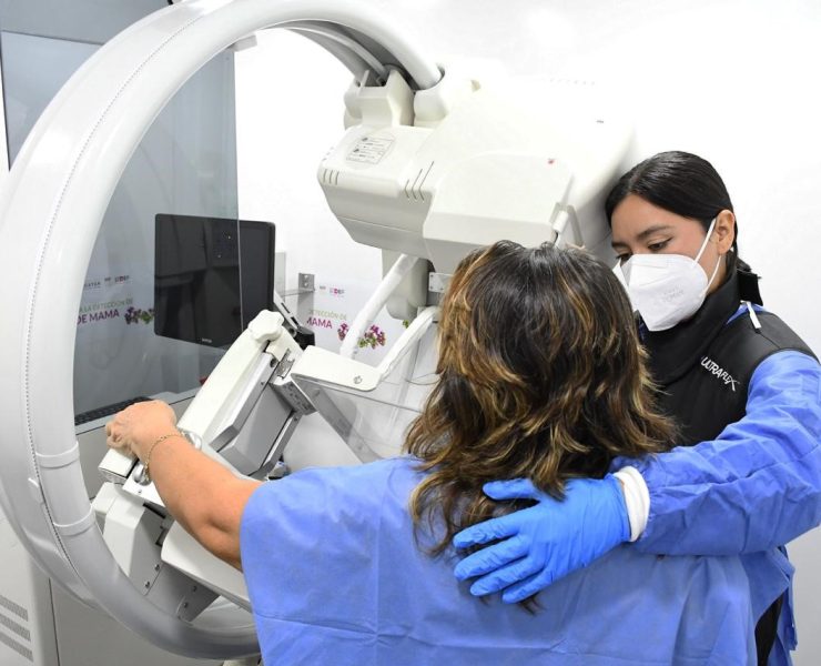 Dos mastógrafos móviles se unen a la lucha contra el cáncer de mama en Yucatán