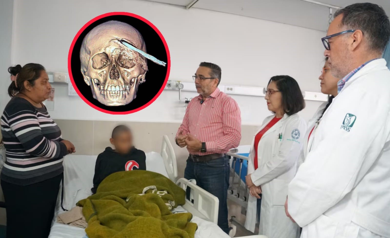 Histórica cirugía en Yucatán: IMSS salva a joven con una coa incrustada en la cabeza