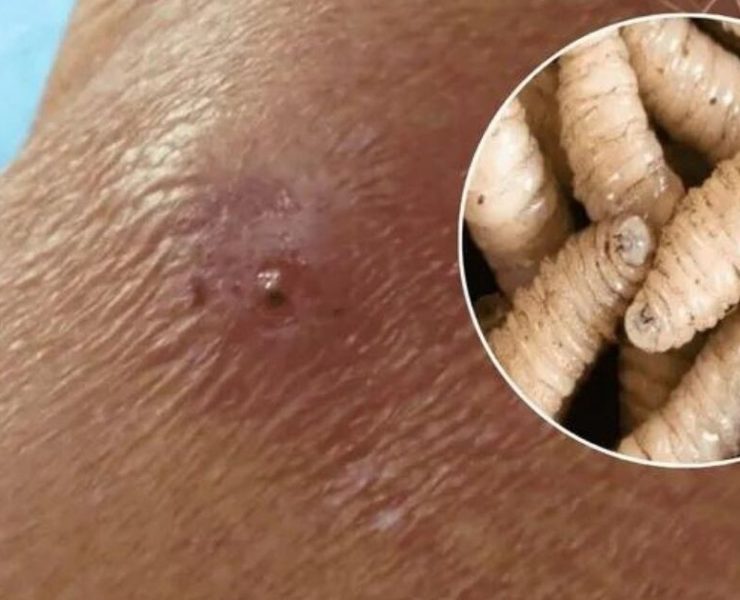 ¡Impactante! Séptimo caso de miasis por gusano barrenadoren pone en alerta a todos