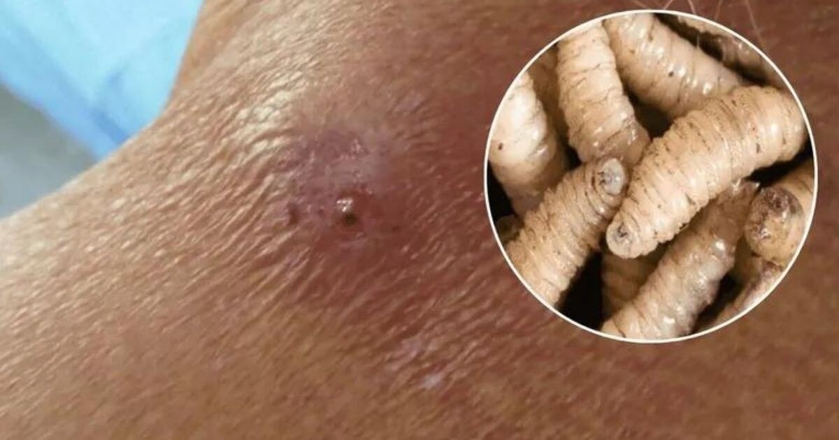 ¡Impactante! Séptimo caso de miasis por gusano barrenadoren pone en alerta a todos