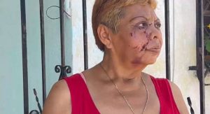 El caso de la mujer atacada por perros Pitbull generó preocupación entre vecinos de la colonia Bojórquez, quienes pidieron mayor seguridad en la zona.
