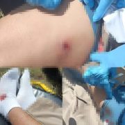 ¡Impactante! Balines lesionan a motociclista en carretera Tizimín-Río Lagartos