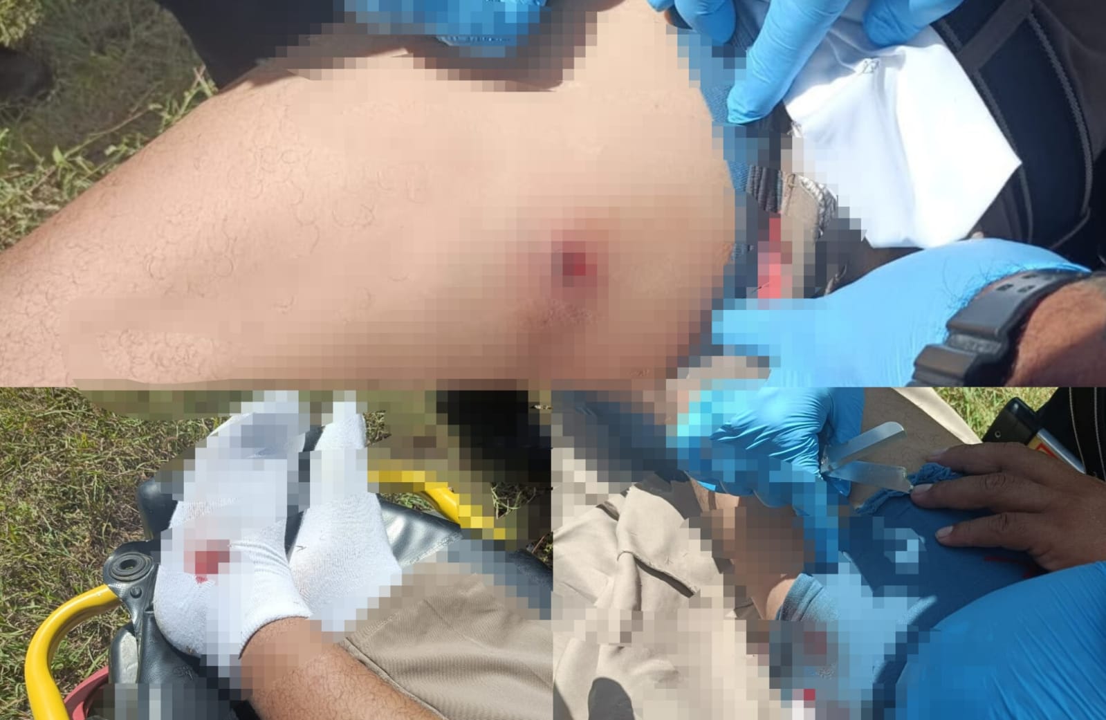 ¡Impactante! Balines lesionan a motociclista en carretera Tizimín-Río Lagartos